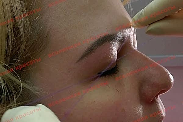 Иллюстрация: на процедуре