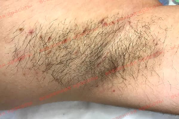 Иллюстрация: до начала