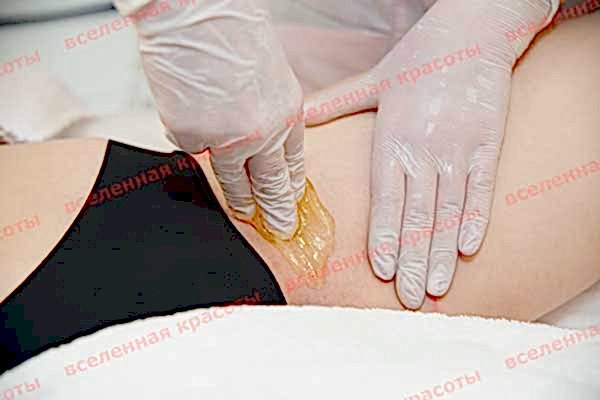 Сахарная эпиляция интимной зоны Иллюстрация