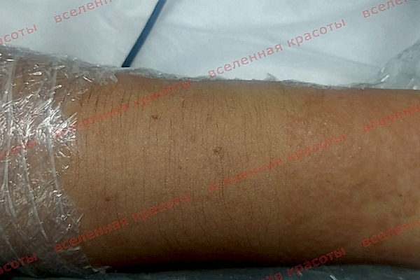 Иллюстрация: до начала