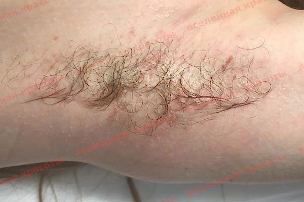 Иллюстрация: до начала