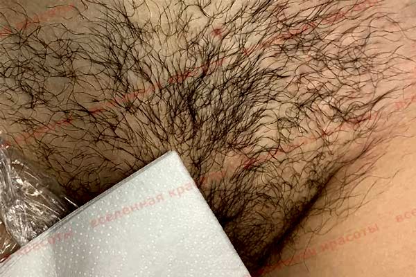 Иллюстрация: до начала