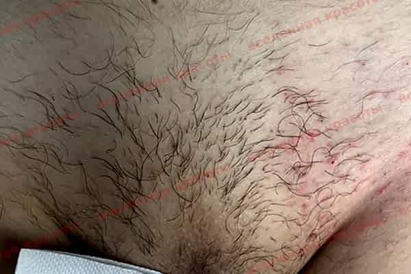 Иллюстрация: до начала