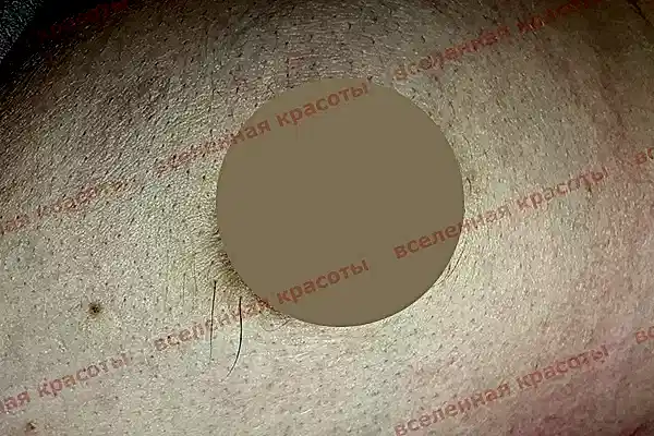 Иллюстрация: до начала