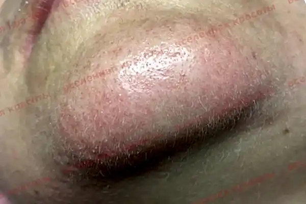 Иллюстрация: до начала