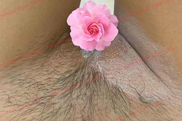 Процедура после Иллюстрация: после сеанса