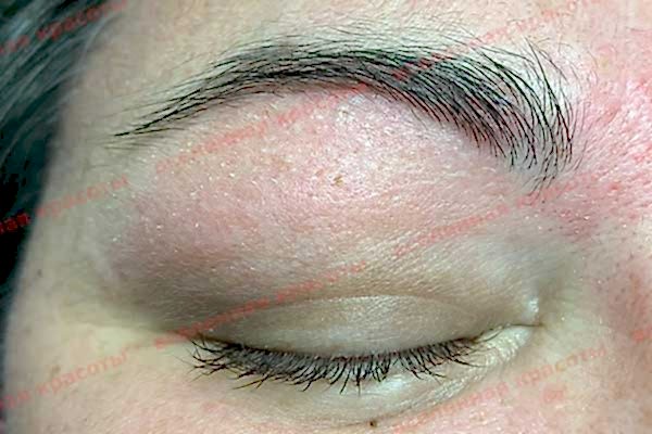 Иллюстрация: после воздействия