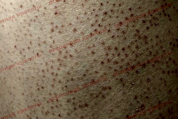 Иллюстрация: спустя 3 дня