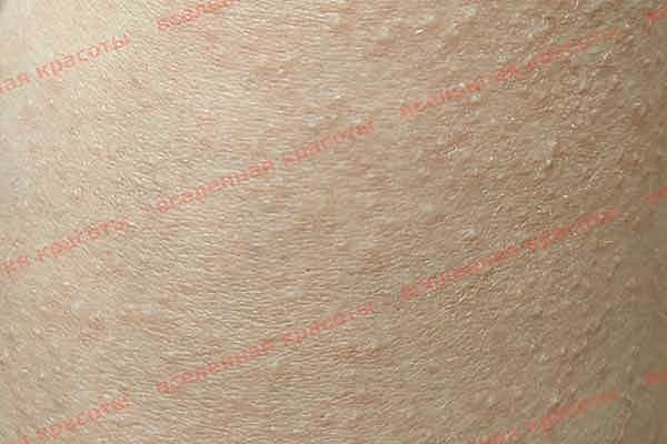 Иллюстрация: сразу после