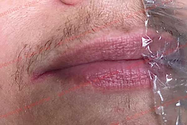 Иллюстрация: до начала