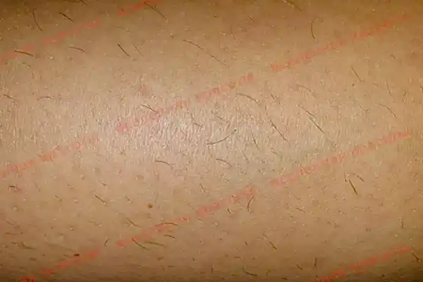 Иллюстрация: после 6 месяцев