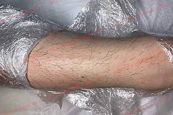 Иллюстрация: до начала