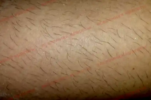 Иллюстрация: до начала