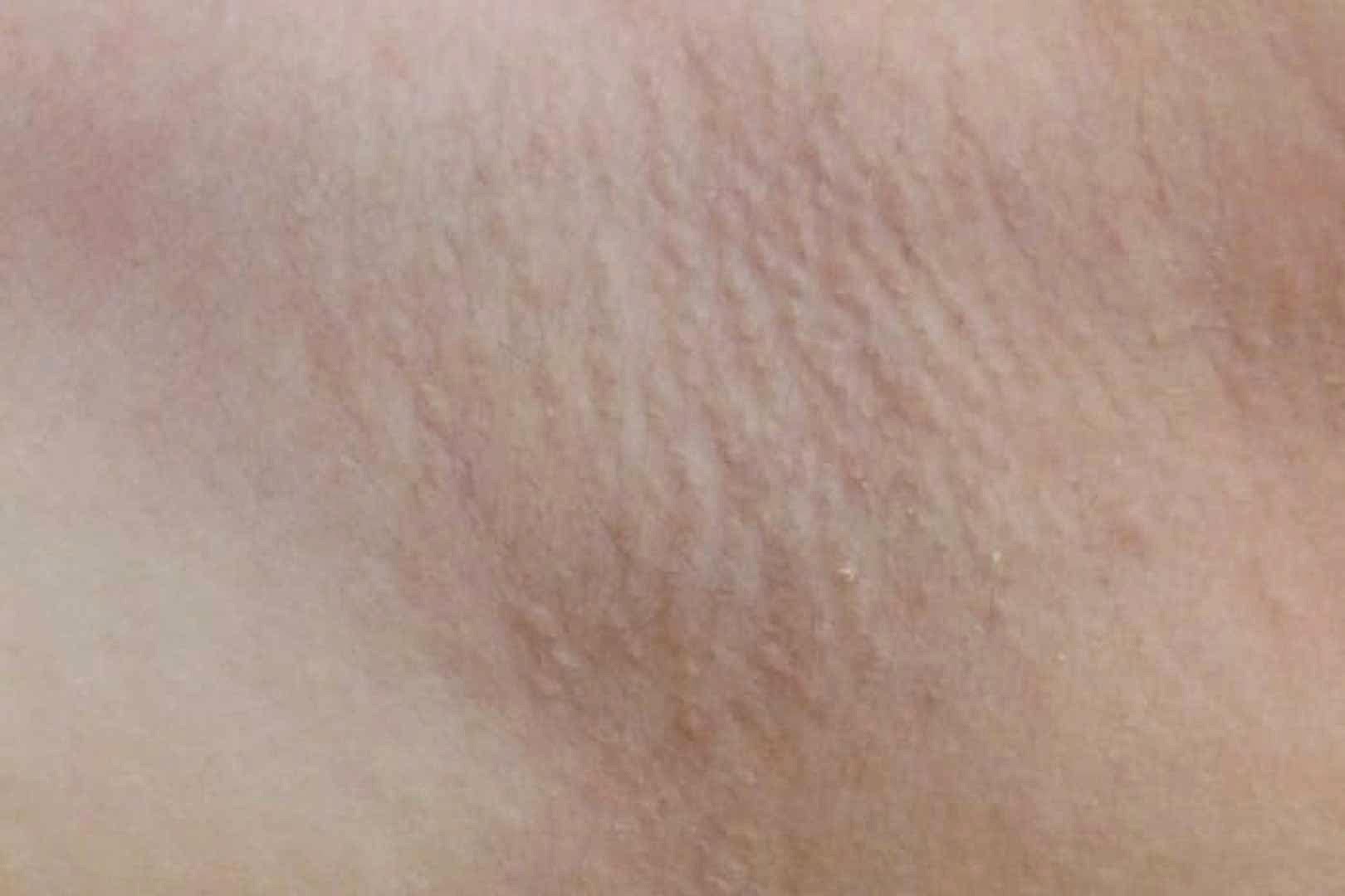 Процедура после, мастер Юля, м. Аэропорт Иллюстрация: после воздействия