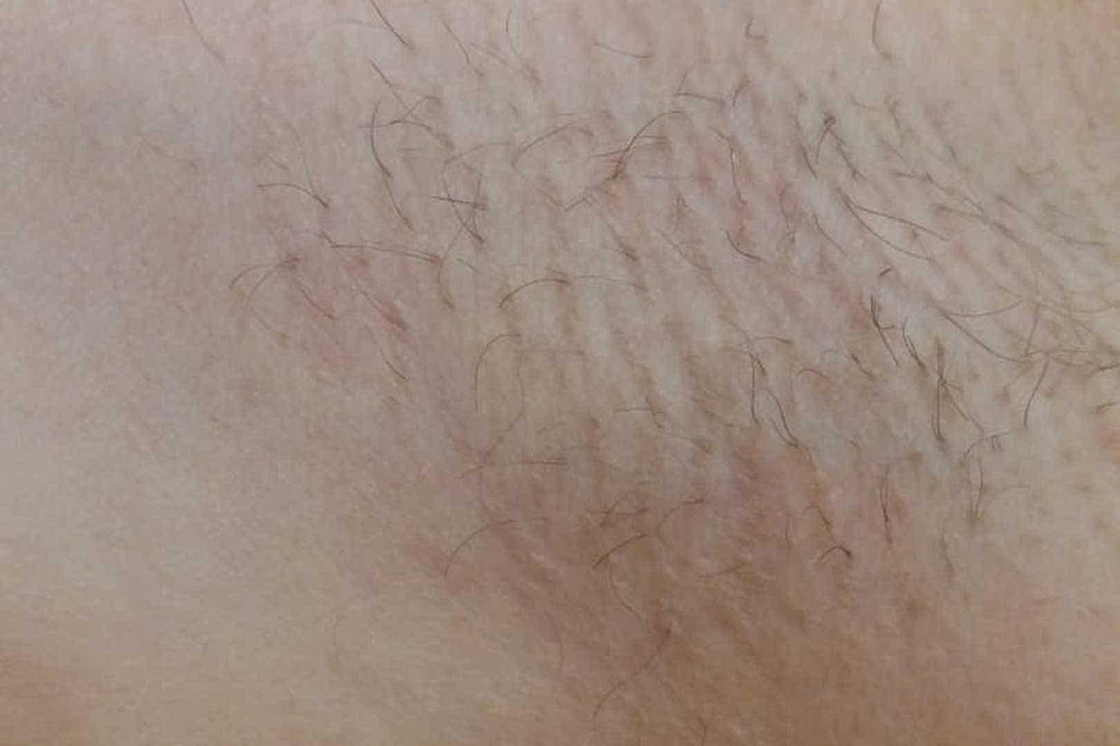 Иллюстрация: до начала